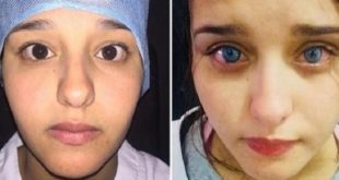 Casablanca : Une marocaine change la couleur de ses yeux !