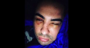 Doc Samad violemment agressé (Photo)