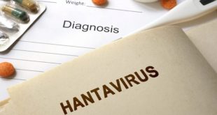 Hantavirus : Cette maladie virale qui crée la panique sur les réseaux sociaux