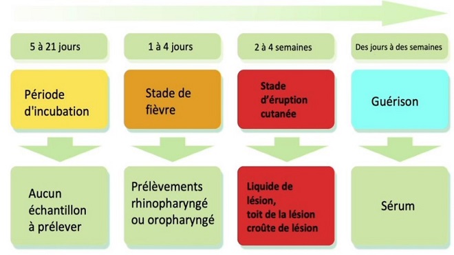 Monkeypox,Symptômes,diagnostic,Variole du singe